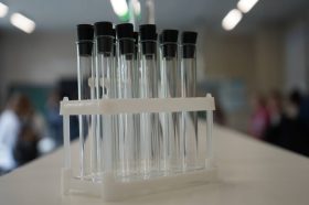 Новую молекулу для лекарства от ПТСР разработали ученые Сеченовского университета. Фото: Анна Быкова, «Вечерняя Москва»
